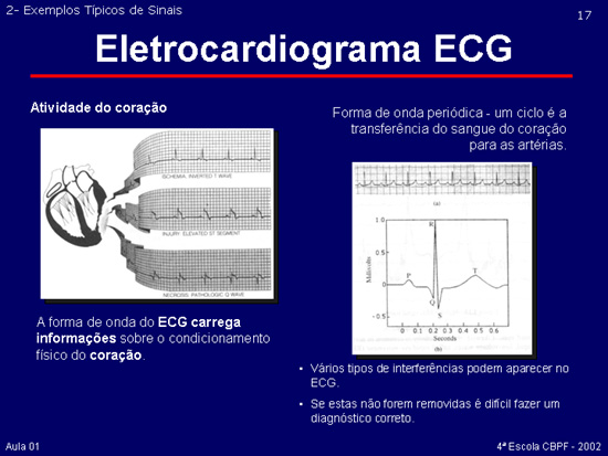 Slide17